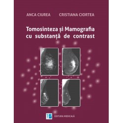 Tomosinteza si mamografia cu substanta de contrast - Anca Ciurea, Cristiana Ciortea